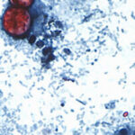 What the Cyclospora Outbreak Reveals