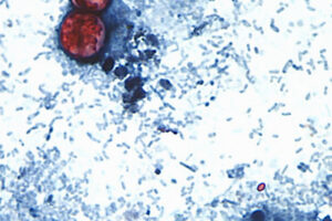 What the Cyclospora Outbreak Reveals