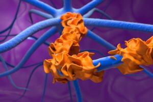 First-of-kind Guillain-Barré drug switches off part of immune system