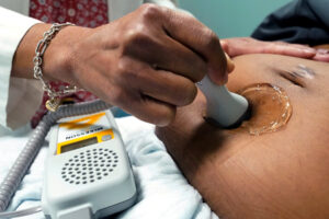 Covid Vaccines Are Not Linked to Miscarriage. Here’s How We Know.