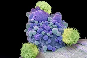 Newly discovered immune hubs in our skull may keep our brain healthy
